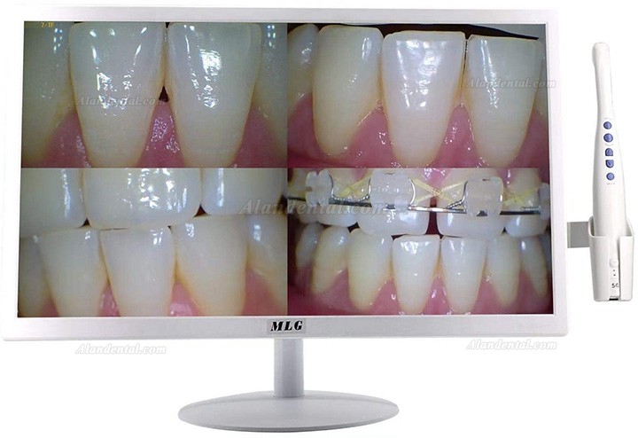 MLG M-978A Dental Intra Oral Camera 5G Wireless WIFI with 19 inch LCD Monitor